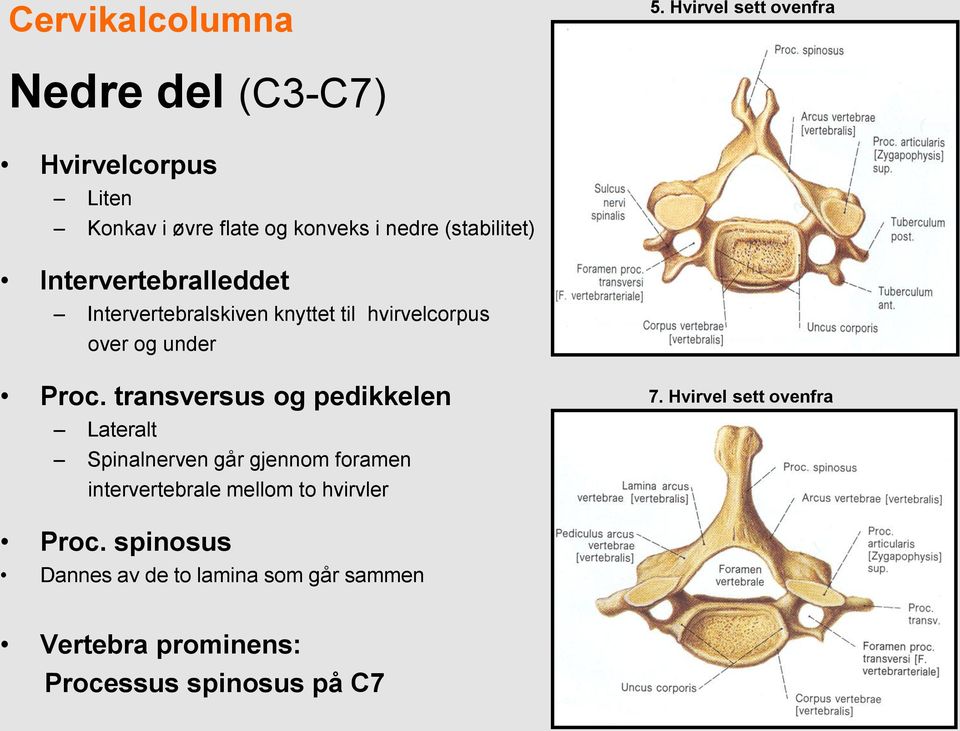 Intervertebralleddet Intervertebralskiven knyttet til hvirvelcorpus over og under Proc.