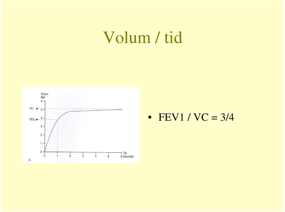 / VC =