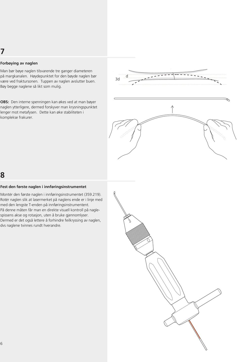 Dette kan øke stabiliteten i komplekse frakurer. 8 Fest den første naglen i innføringsinstrumentet Montér den første naglen i innføringsinstrumentet (359.219).