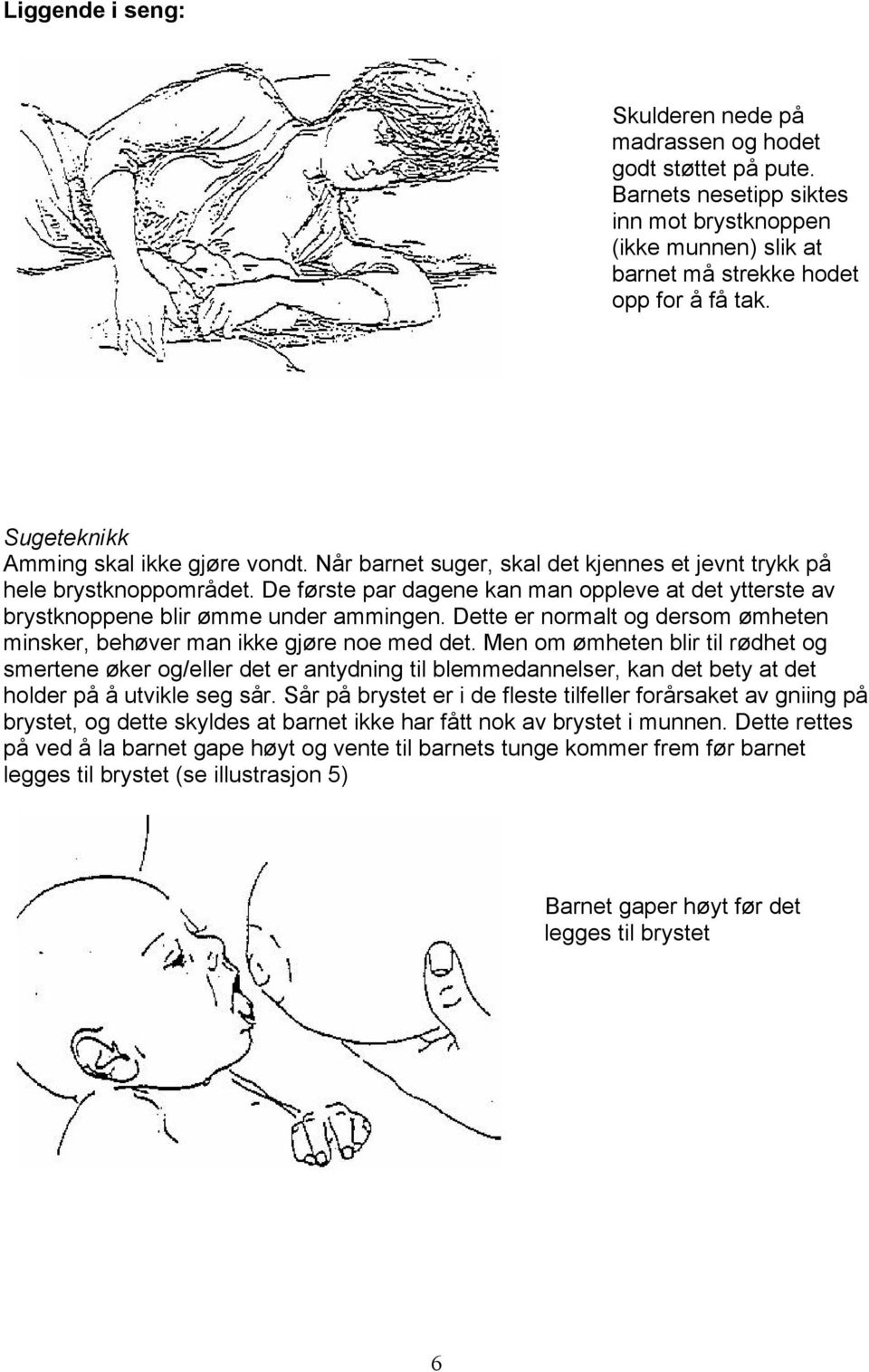 De første par dagene kan man oppleve at det ytterste av brystknoppene blir ømme under ammingen. Dette er normalt og dersom ømheten minsker, behøver man ikke gjøre noe med det.