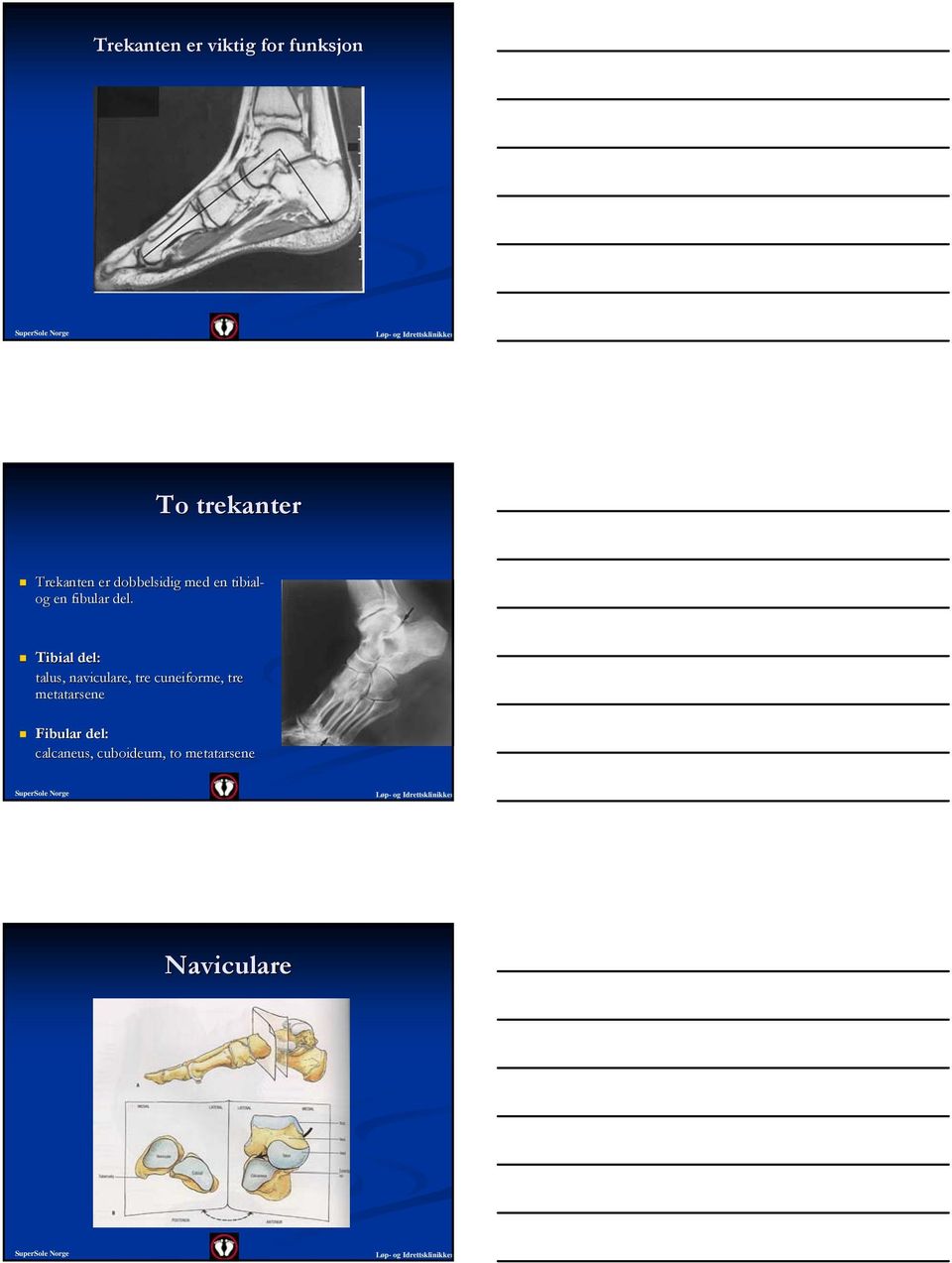 med en tibial- og en fibular del.