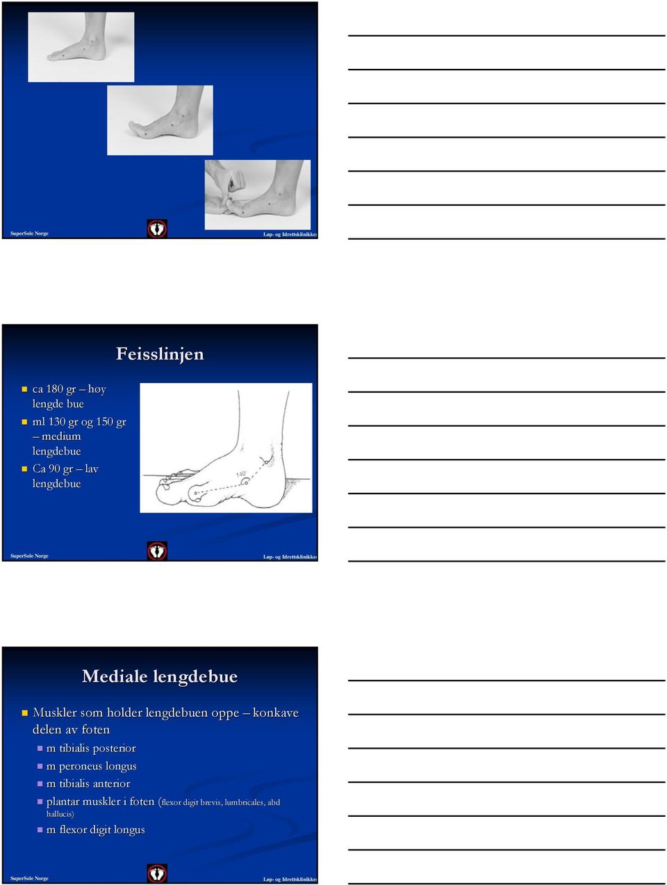 konkave delen av foten m tibialis posterior m peroneus longus m tibialis anterior