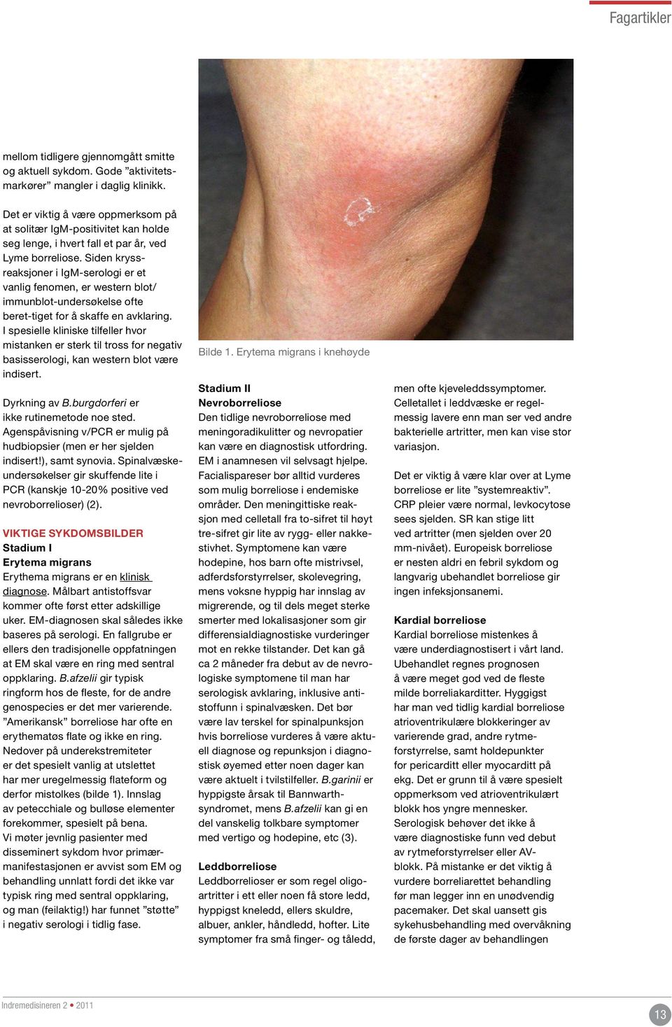 Siden kryssreaksjoner i IgM-serologi er et vanlig fenomen, er western blot/ immunblot-undersøkelse ofte beret-tiget for å skaffe en avklaring.