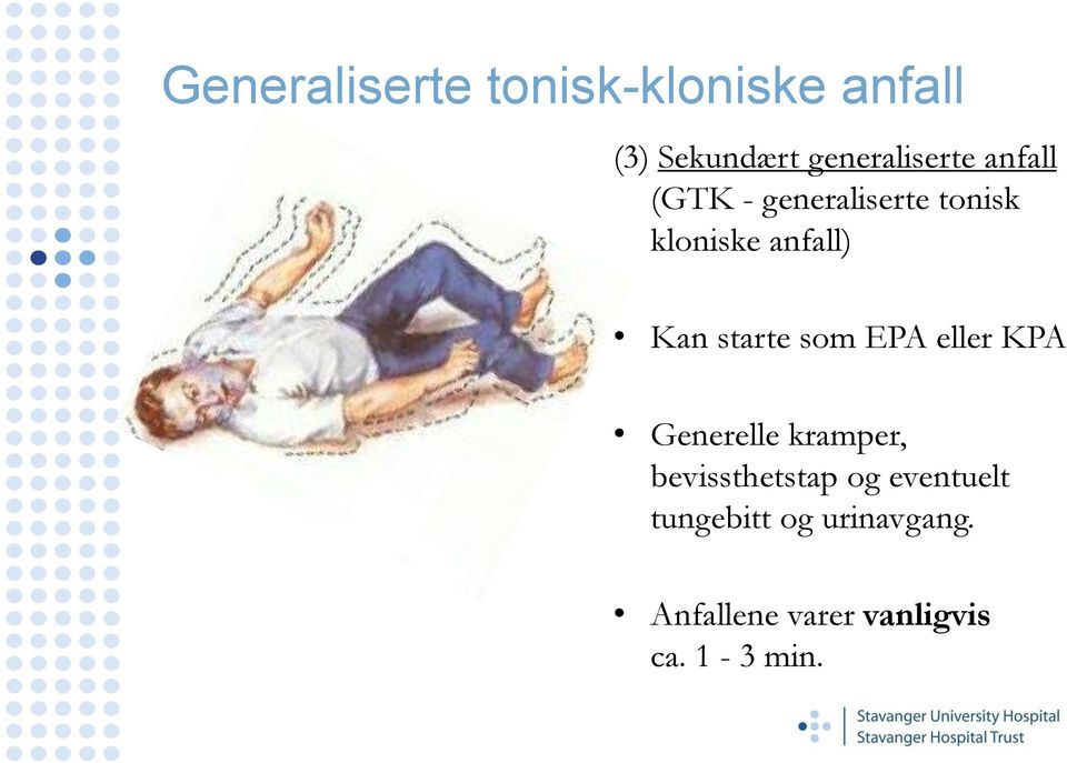 som EPA eller KPA Generelle kramper, bevissthetstap og eventuelt