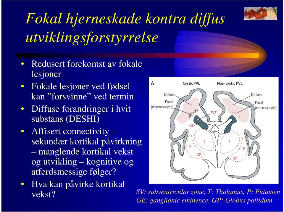 sekundær kortikal påvirkning manglende kortikal vekst og utvikling kognitive og atferdsmessige følger?