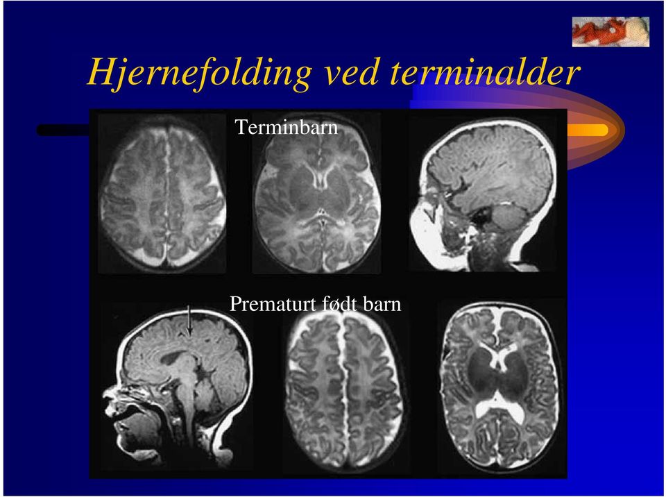 terminalder