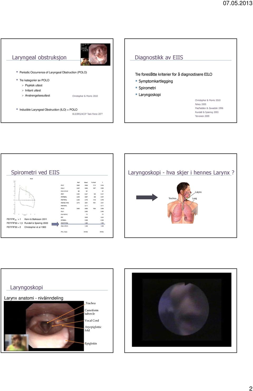 ? Tre foreslåtte kriterier for å diagnostisere EILO Symptomkartlegging Spirometri Laryngoskopi Christopher & Morris 2010 Fahey 2005 MacFadden & Zawadski 1996 Rundell & Spiering 2003