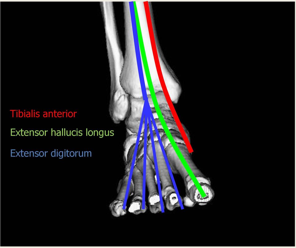 Extensor