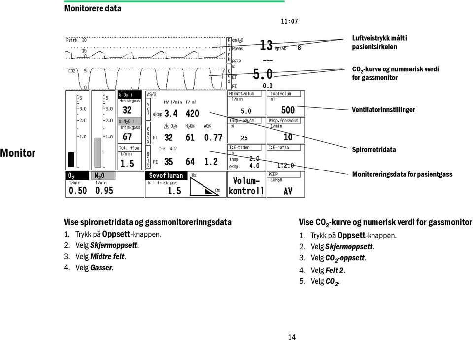 gassmonitorerinngsdata 1. Trykk på Oppsett-knappen. 2. Velg Skjermoppsett. 3. Velg Midtre felt. 4. Velg Gasser.