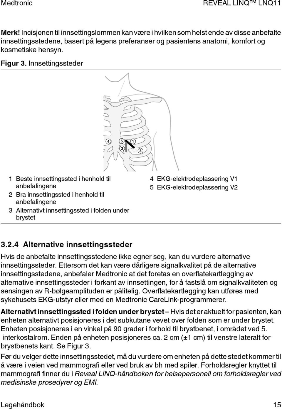 Innsettingssteder 1 Beste innsettingssted i henhold til anbefalingene 2 Bra innsettingssted i henhold til anbefalingene 3 Alternativt innsettingssted i folden under brystet 4 EKG-elektrodeplassering