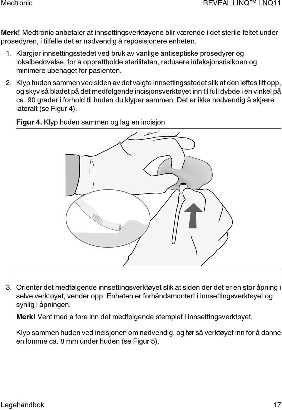 Klyp huden sammen ved siden av det valgte innsettingsstedet slik at den løftes litt opp, og skyv så bladet på det medfølgende incisjonsverktøyet inn til full dybde i en vinkel på ca.