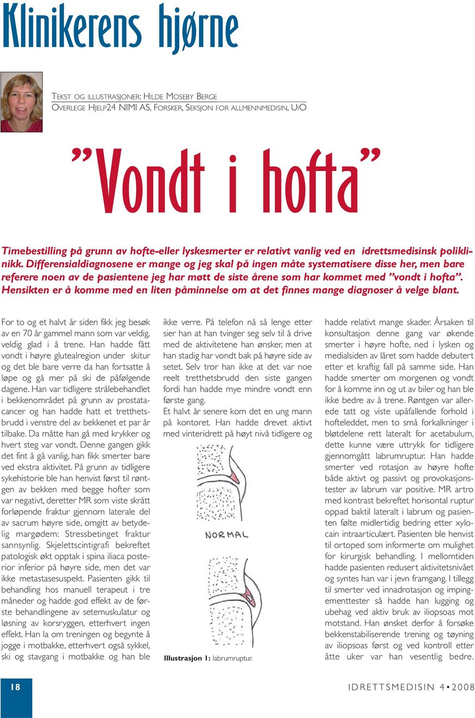 Differensialdiagnosene er mange og jeg skal på ingen måte systematisere disse her, men bare referere noen av de pasientene jeg har møtt de siste årene som har kommet med vondt i hofta.