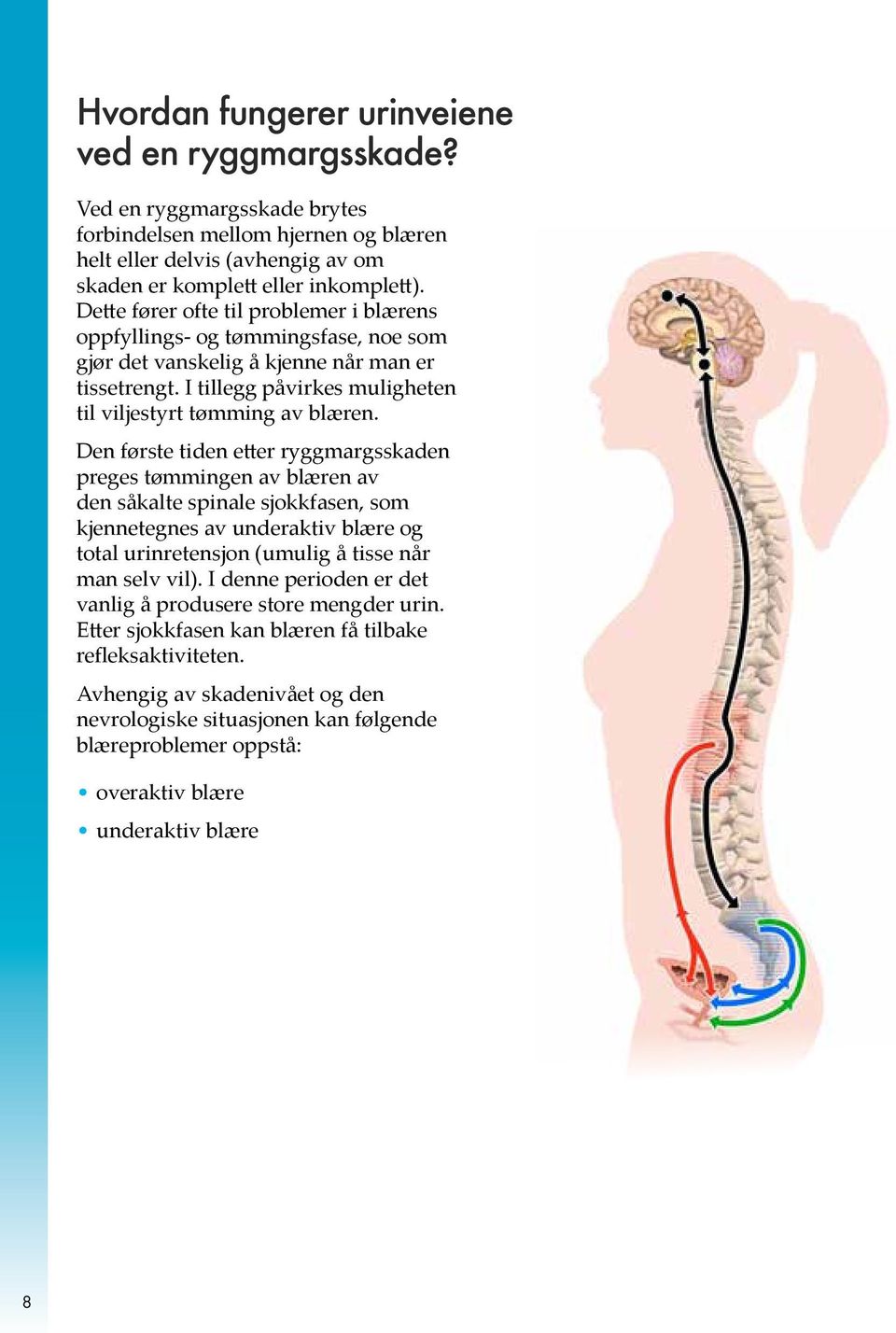 Den første tiden etter ryggmargsskaden preges tømmingen av blæren av den såkalte spinale sjokkfasen, som kjennetegnes av underaktiv blære og total urinretensjon (umulig å tisse når man selv vil).