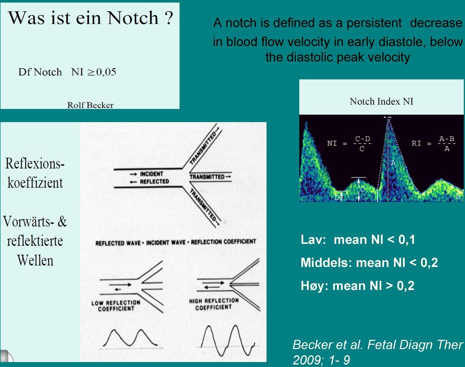 peak velocity Lav: mean NI < 0,1 Middels: mean NI < 0,2