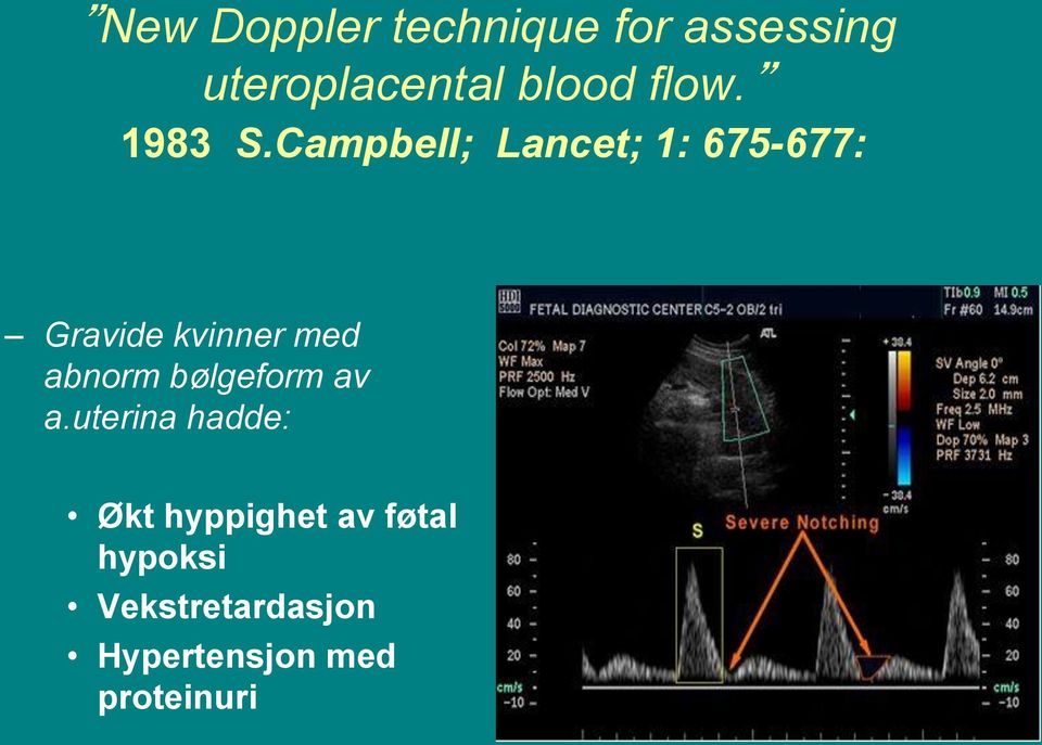 Campbell; Lancet; 1: 675-677: Gravide kvinner med abnorm