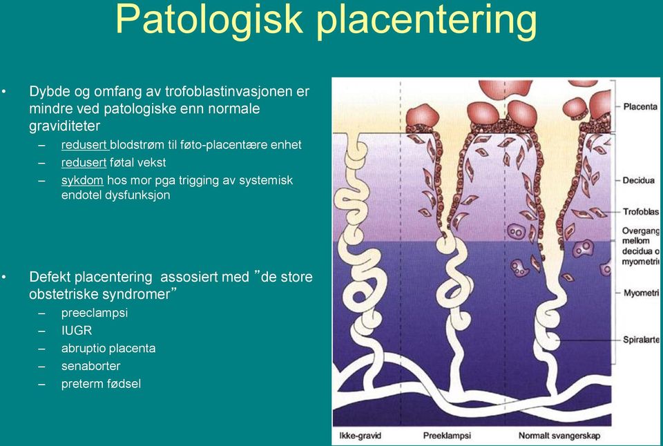 sykdom hos mor pga trigging av systemisk endotel dysfunksjon Defekt placentering assosiert