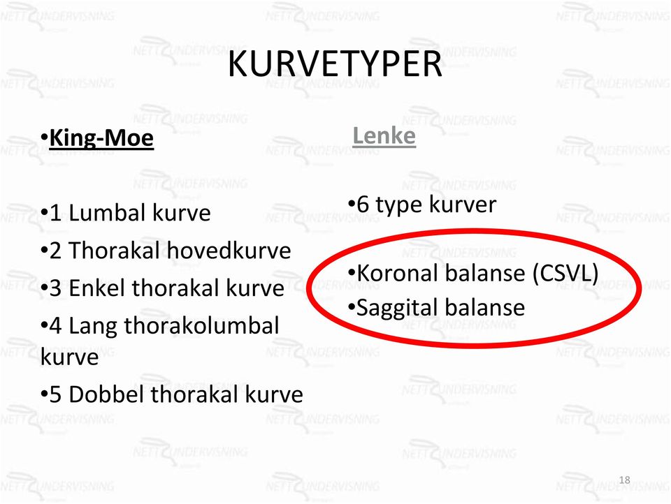 Lang thorakolumbal kurve 5 Dobbel thorakal kurve