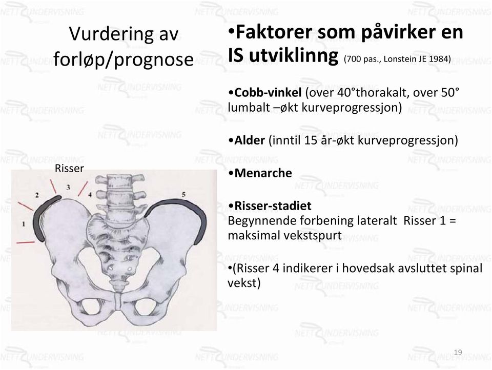 Alder (inntil 15 år økt kurveprogressjon) Risser Menarche Risser stadiet Begynnende