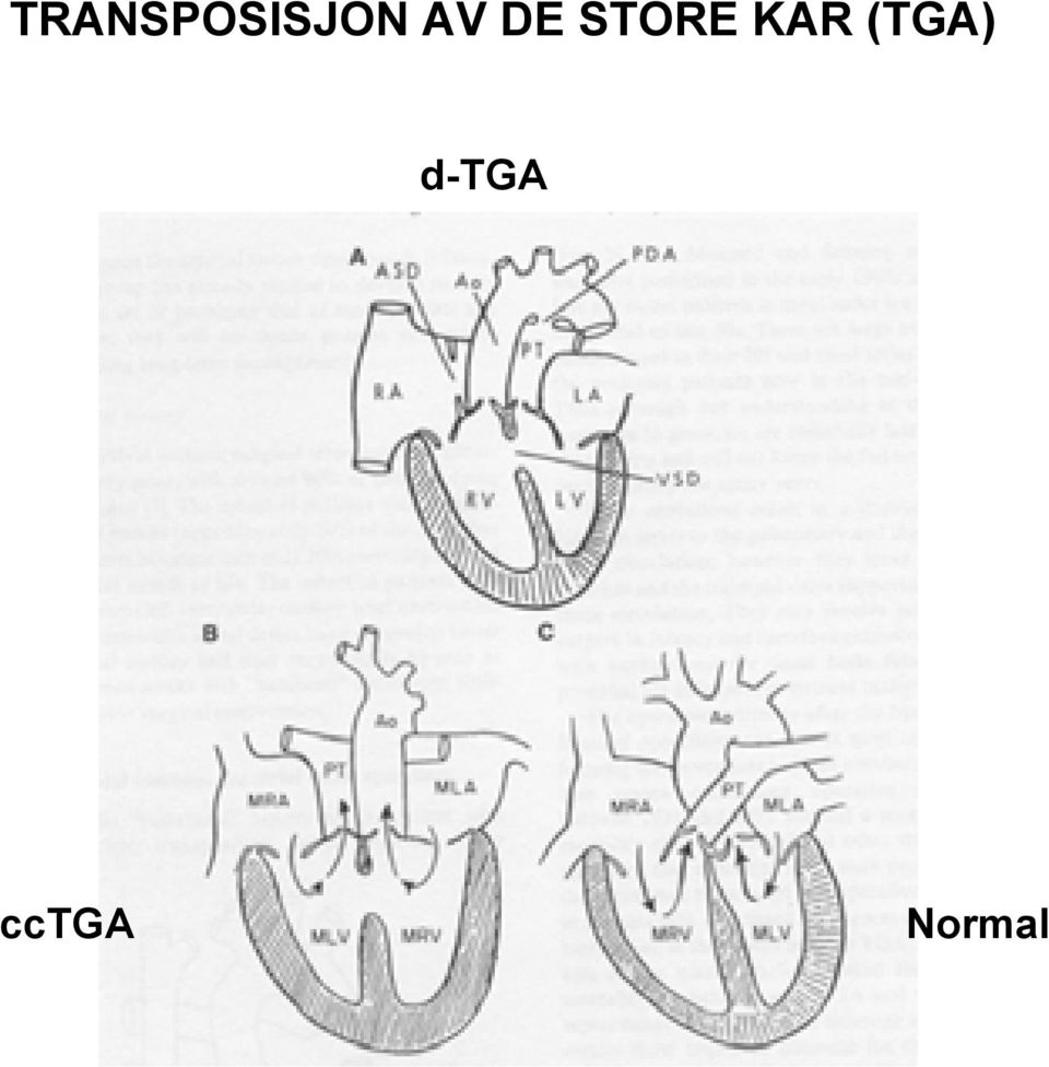 KAR (TGA)