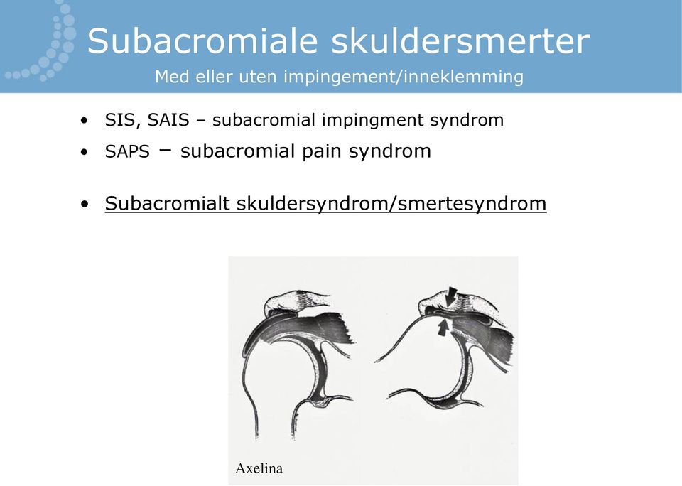 impingment syndrom SAPS subacromial pain