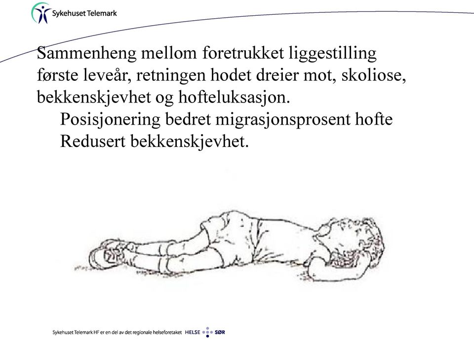 skoliose, bekkenskjevhet og hofteluksasjon.