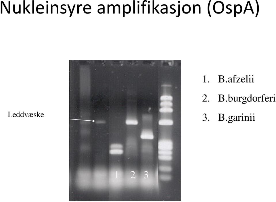 B.afzelii 2. B.