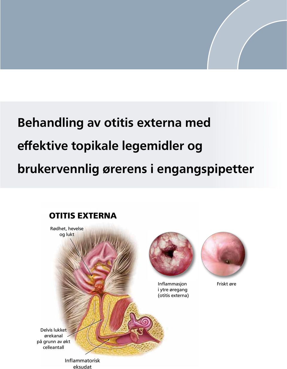 Rødhet, hevelse og lukt Inflammasjon i ytre øregang (otitis externa)