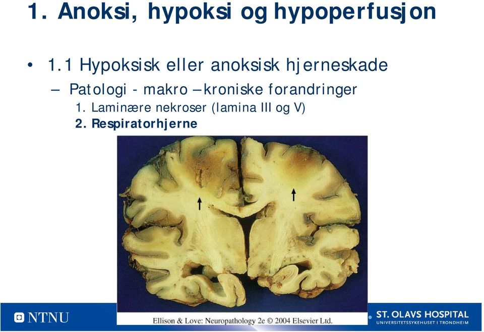 Patologi - makro kroniske forandringer 1.