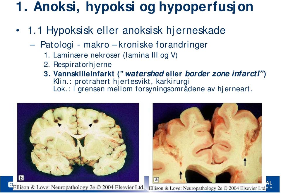 Laminære nekroser (lamina III og V) 2. Respiratorhjerne 3.