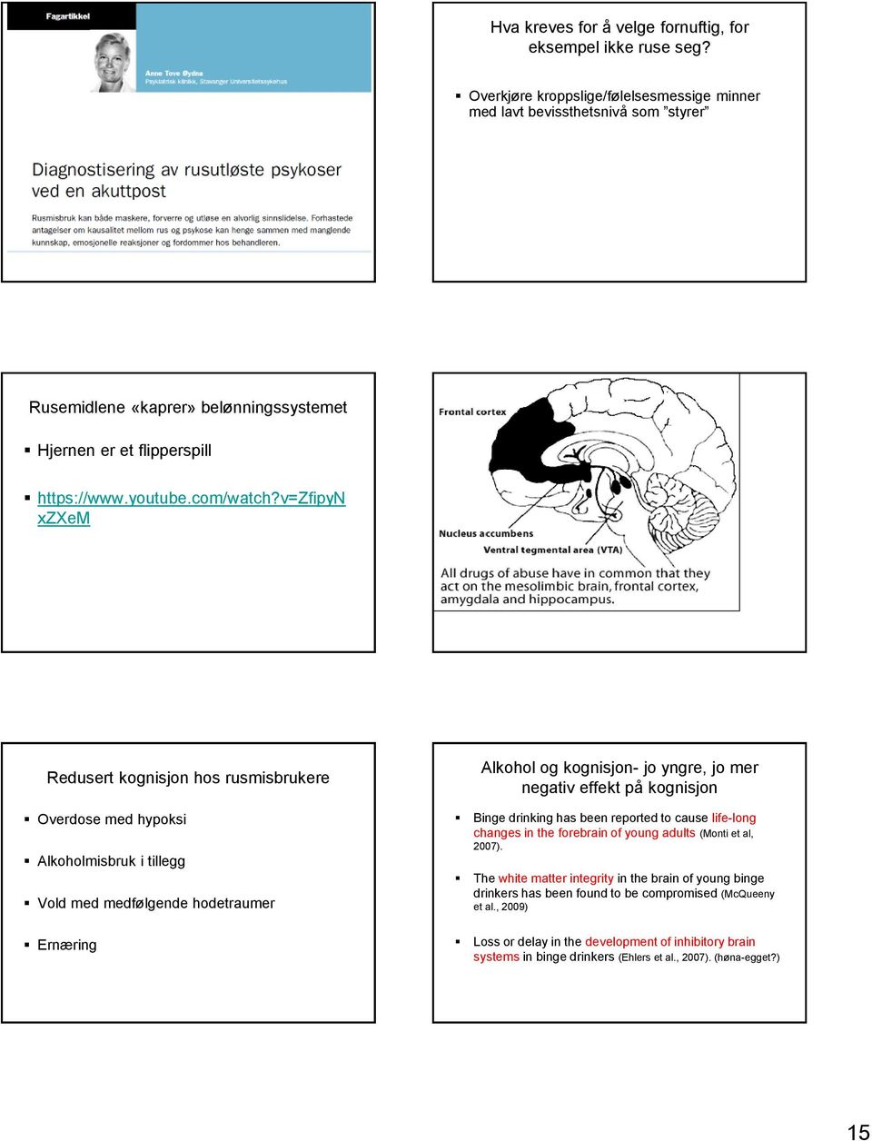 v=zfipyn xzxem Redusert kognisjon hos rusmisbrukere Overdose med hypoksi Alkoholmisbruk i tillegg Vold med medfølgende hodetraumer Ernæring Alkohol og kognisjon- jo yngre, jo mer negativ effekt på