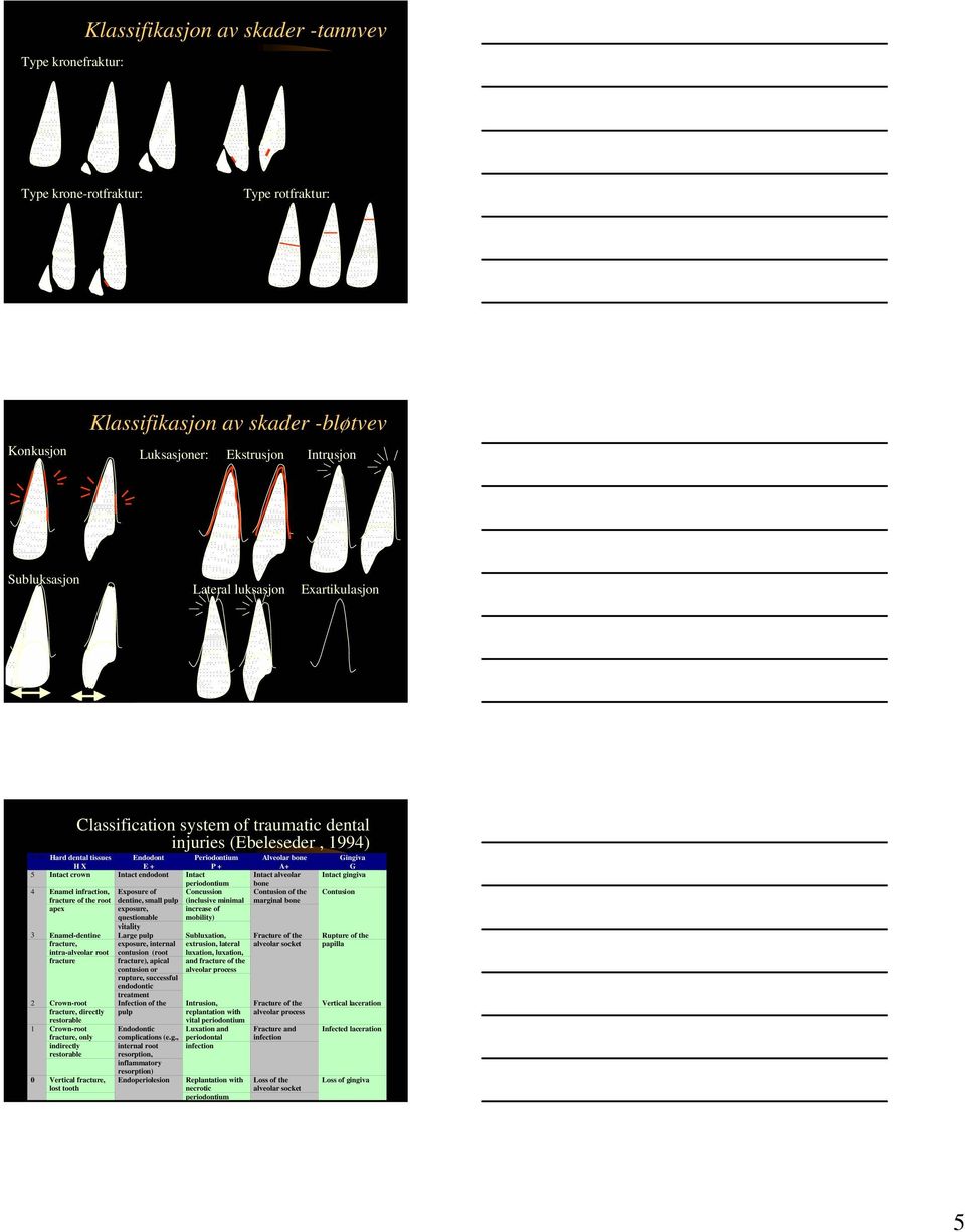 periodontium 4 Enamel infraction, fracture of the root apex 3 Enamel-dentine fracture, intra-alveolar root fracture 2 Crown-root fracture, directly restorable 1 Crown-root fracture, only indirectly