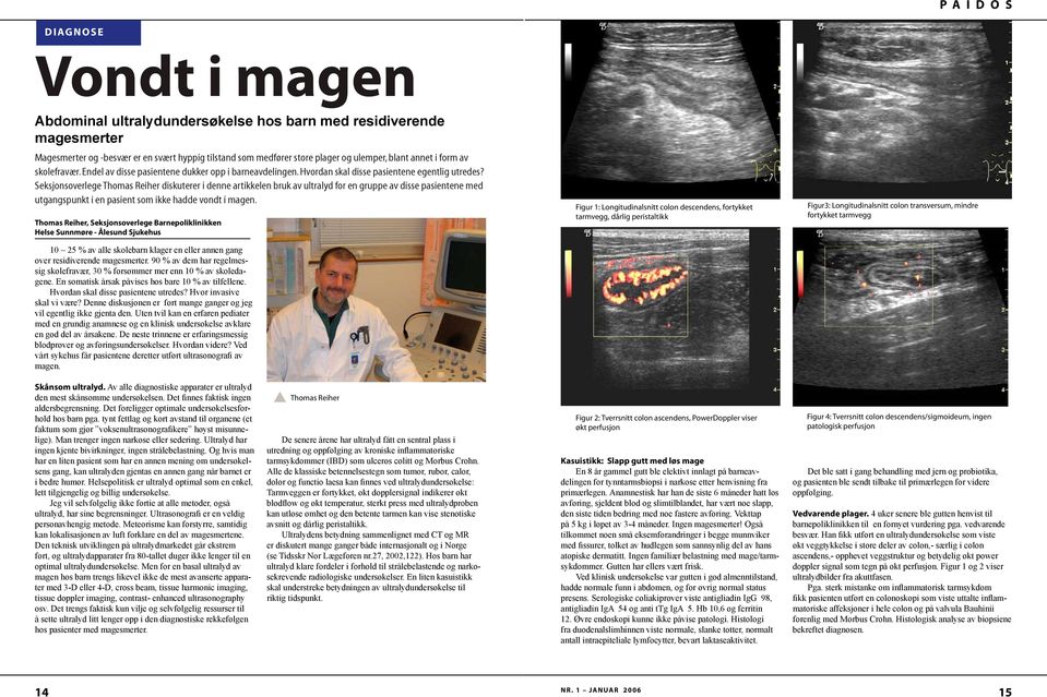 Seksjonsoverlege Thomas Reiher diskuterer i denne artikkelen bruk av ultralyd for en gruppe av disse pasientene med utgangspunkt i en pasient som ikke hadde vondt i magen.