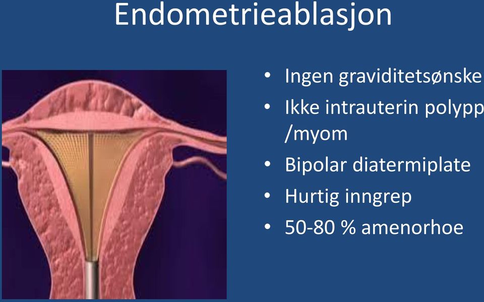 intrauterin polypp /myom