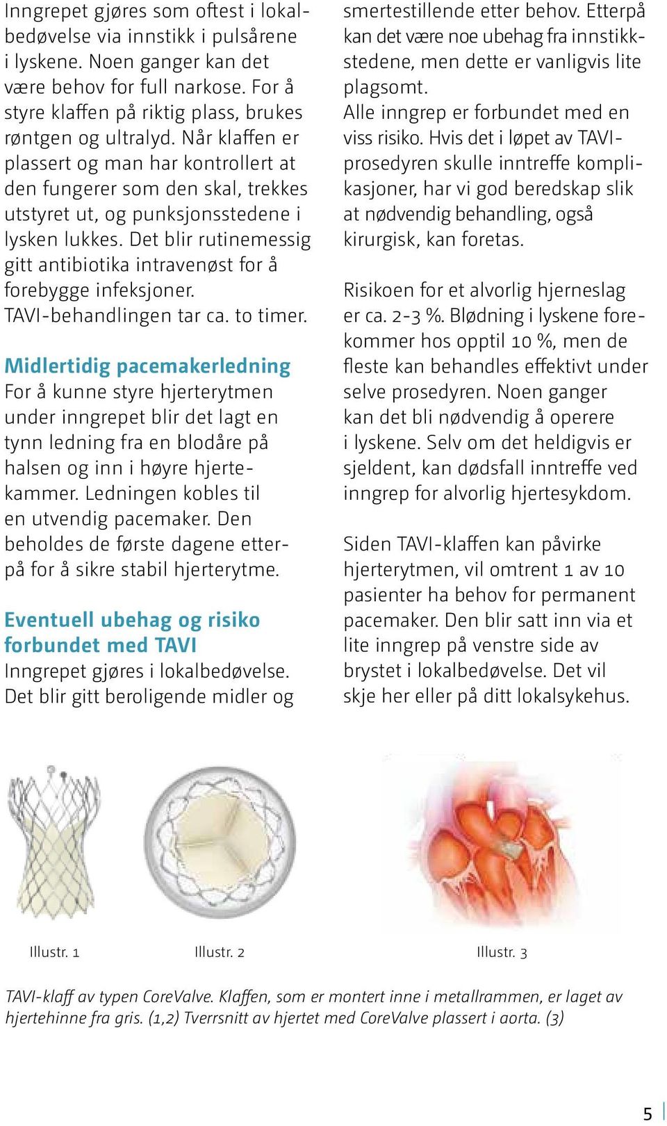 Det blir rutinemessig gitt antibiotika intravenøst for å forebygge infeksjoner. TAVI-behandlingen tar ca. to timer.