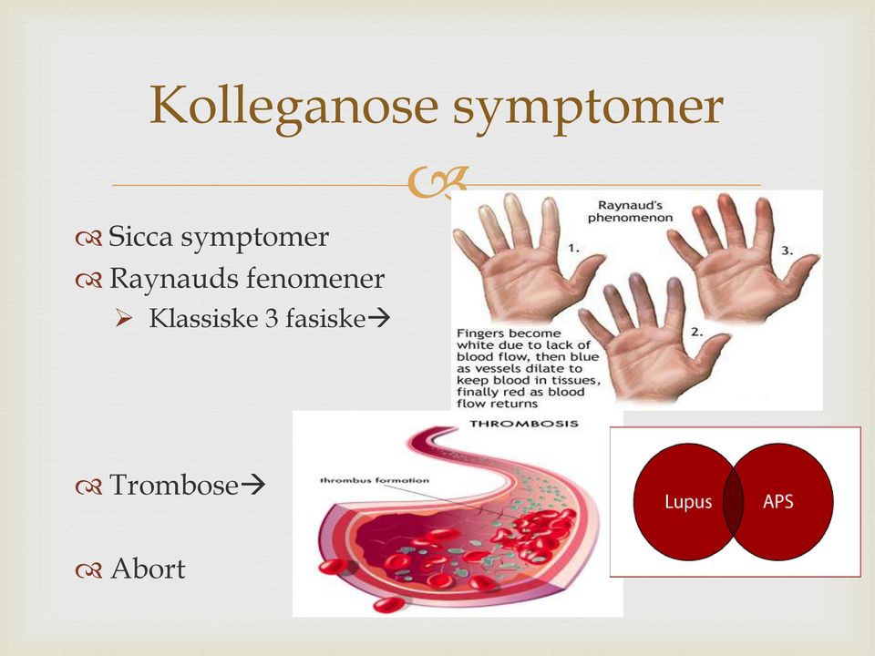 Raynauds fenomener