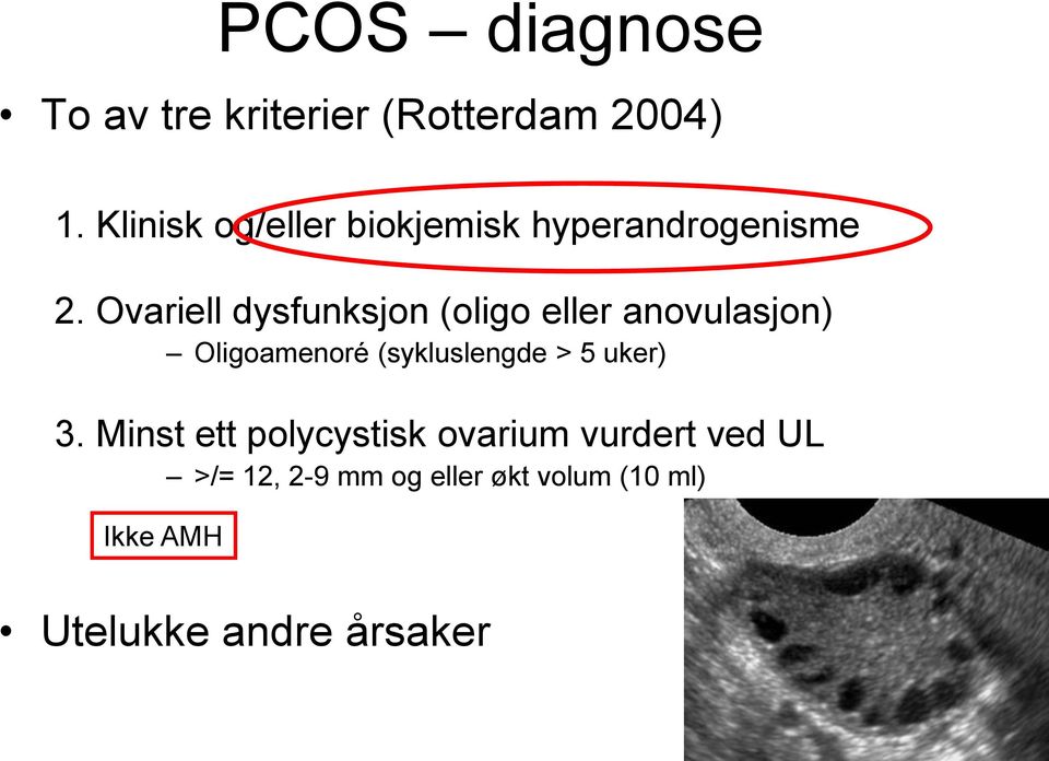 Ovariell dysfunksjon (oligo eller anovulasjon) Oligoamenoré (sykluslengde >