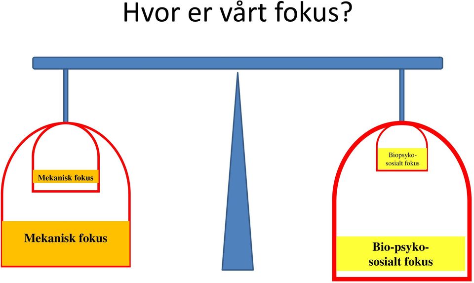 Mekanisk fokus Mekanisk