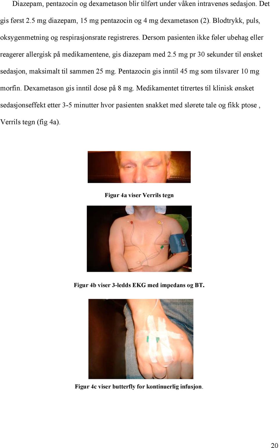 5 mg pr 30 sekunder til ønsket sedasjon, maksimalt til sammen 25 mg. Pentazocin gis inntil 45 mg som tilsvarer 10 mg morfin. Dexametason gis inntil dose på 8 mg.