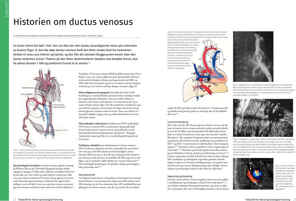 Den ble døpt ductus venosus fordi den førte venøst blod fra navlevenen direkte til vena cava inferior og hjertet, og den fikk det latinske tilleggsnavnet Arantii etter den kjente anatomen Aranzi i