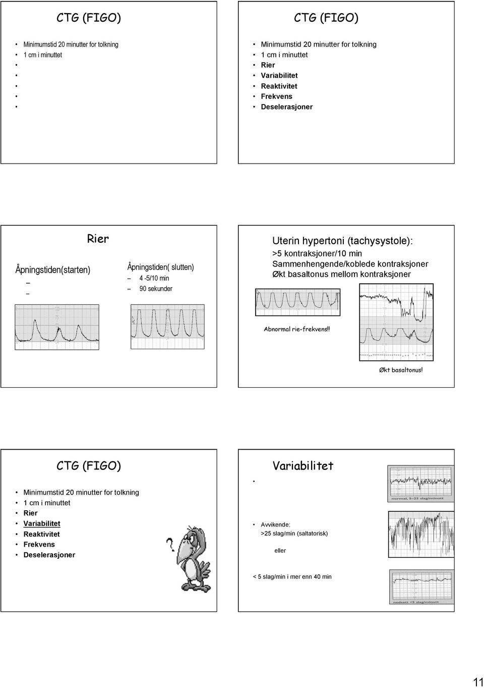 30-60 sekunder Rier Åpningstiden( slutten) 4-5/10 min 90 sekunder Uterin hypertoni (tachysystole): >5 kontraksjoner/10 min Sammenhengende/koblede kontraksjoner Økt basaltonus mellom