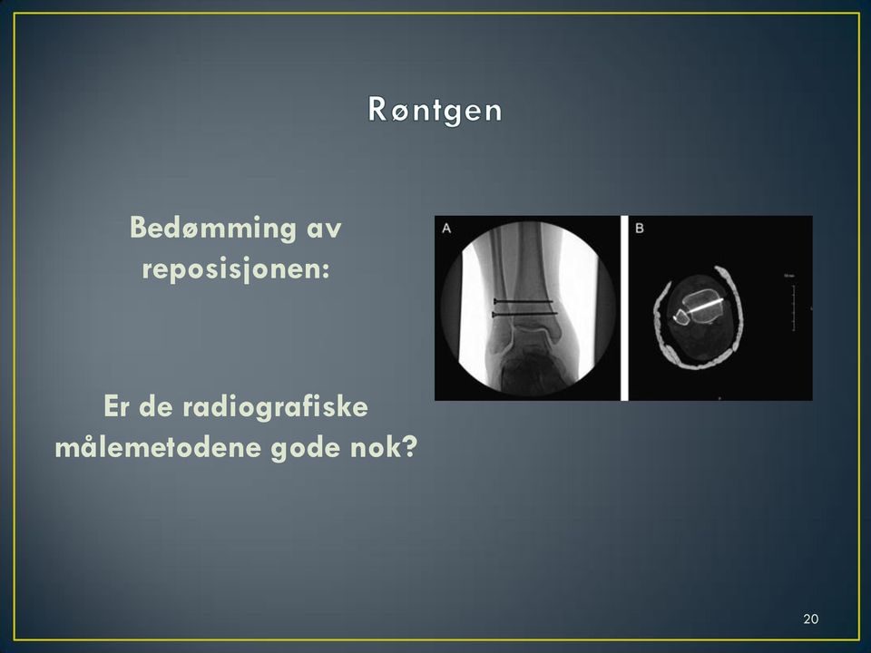 de radiografiske