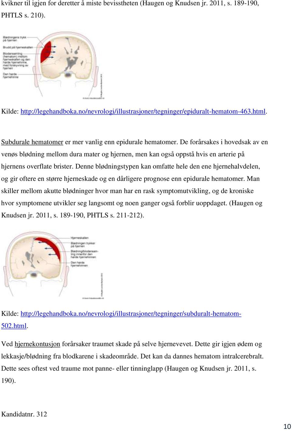 De forårsakes i hovedsak av en venøs blødning mellom dura mater og hjernen, men kan også oppstå hvis en arterie på hjernens overflate brister.