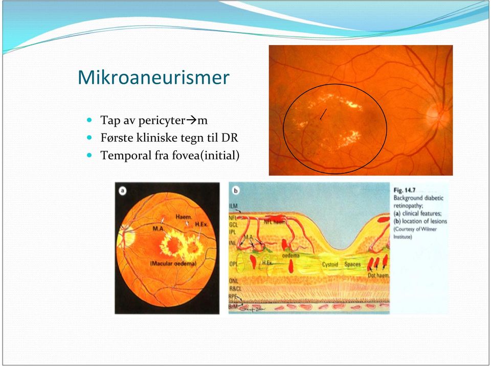 kliniske tegn til DR