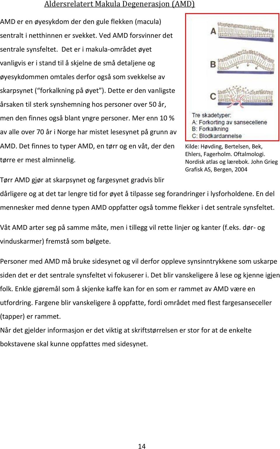 Dette er den vanligste årsaken til sterk synshemning hos personer over 50 år, men den finnes også blant yngre personer. Mer enn 10 % av alle over 70 år i Norge har mistet lesesynet på grunn av AMD.