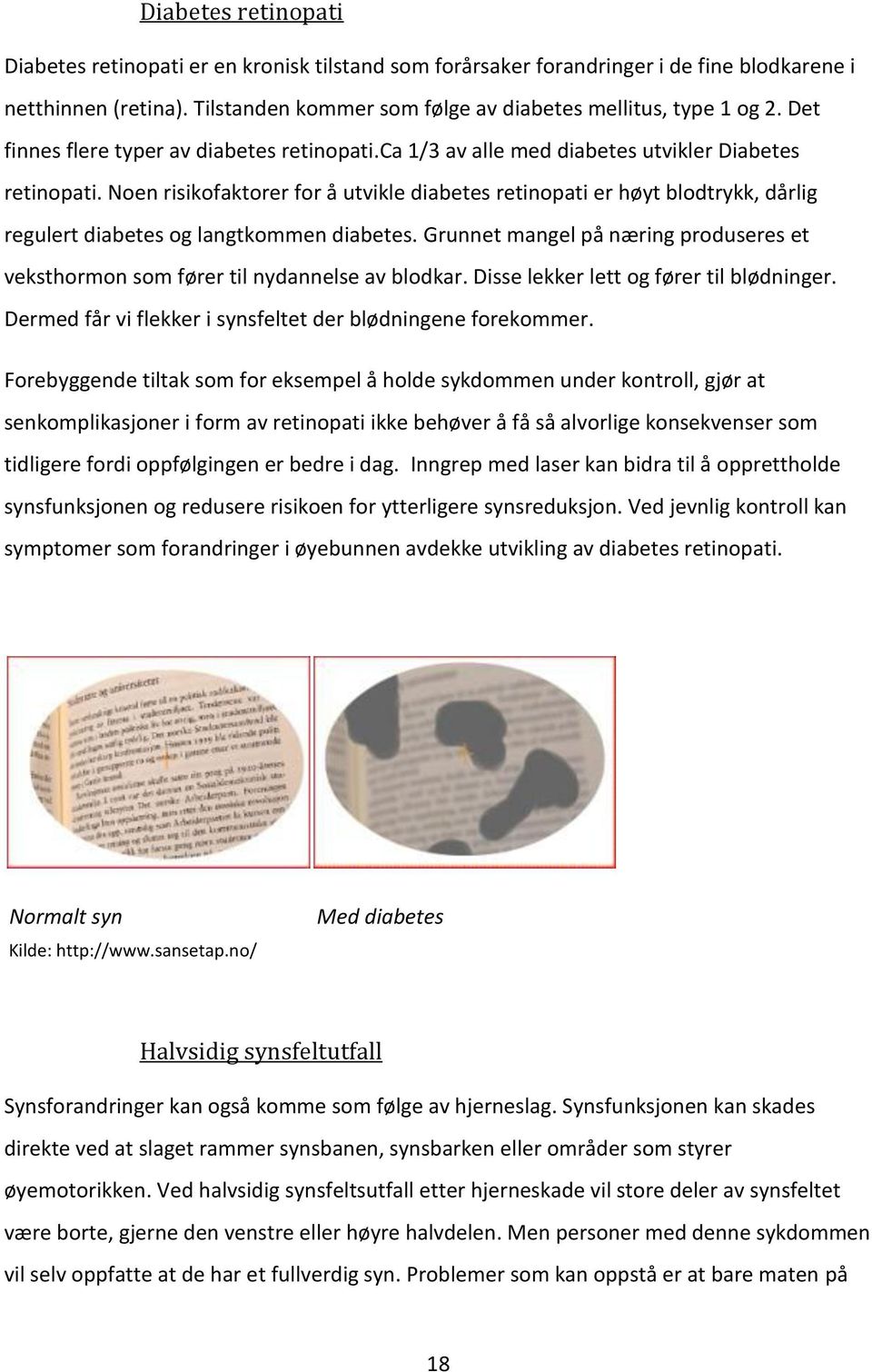 Noen risikofaktorer for å utvikle diabetes retinopati er høyt blodtrykk, dårlig regulert diabetes og langtkommen diabetes.