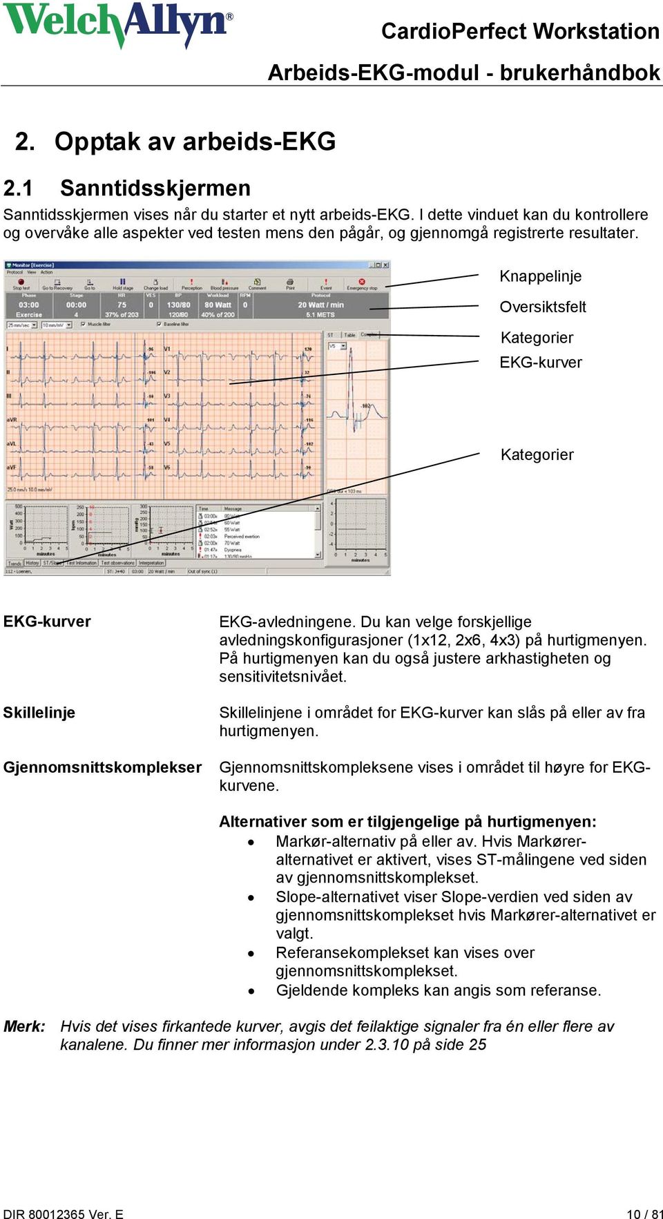 Knappelinje Oversiktsfelt Kategorier EKG-kurver Kategorier EKG-kurver Skillelinje Gjennomsnittskomplekser EKG-avledningene.