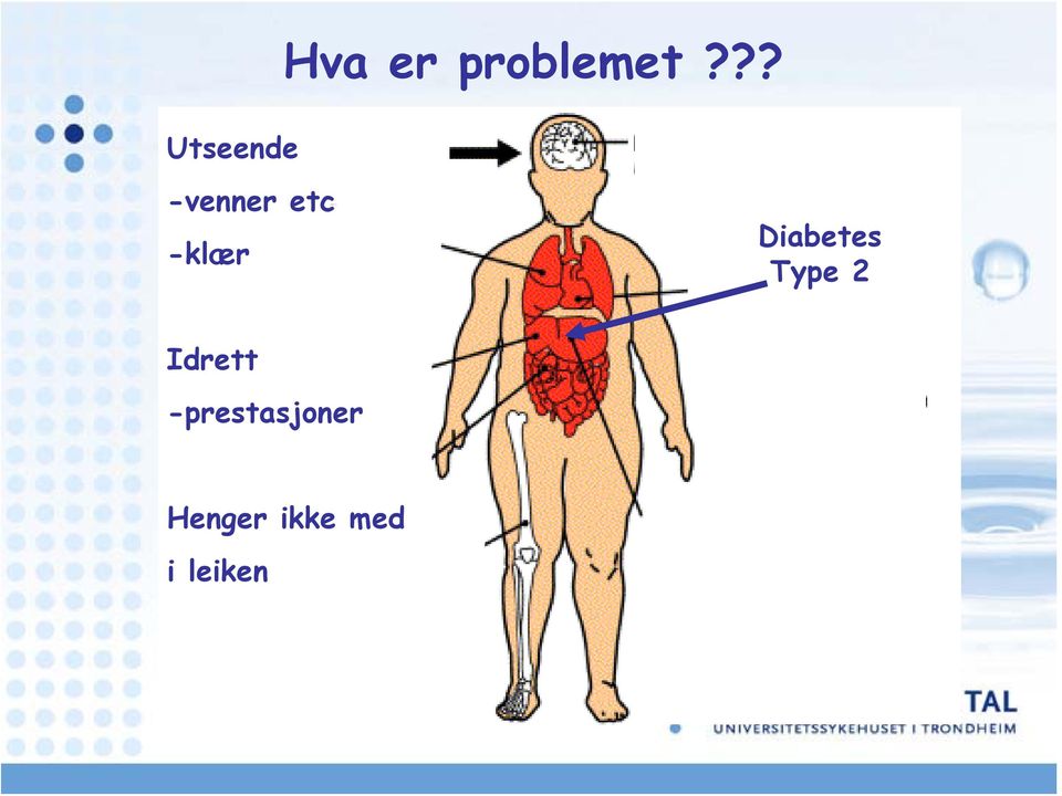 Diabetes Type 2 Idrett