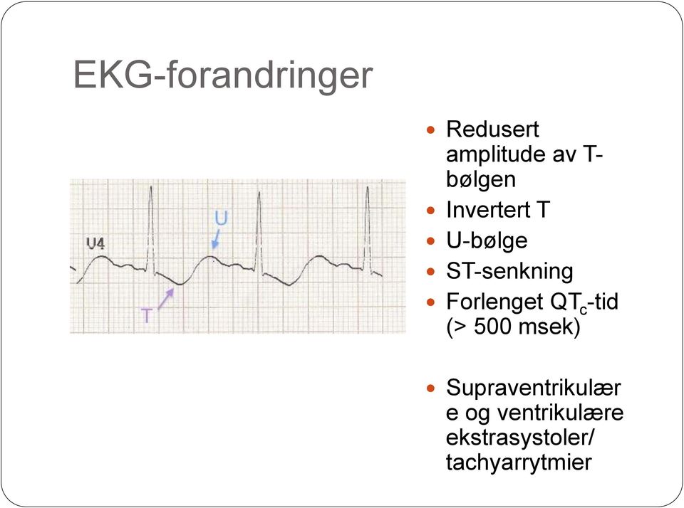 Forlenget QT c -tid (> 500 msek)