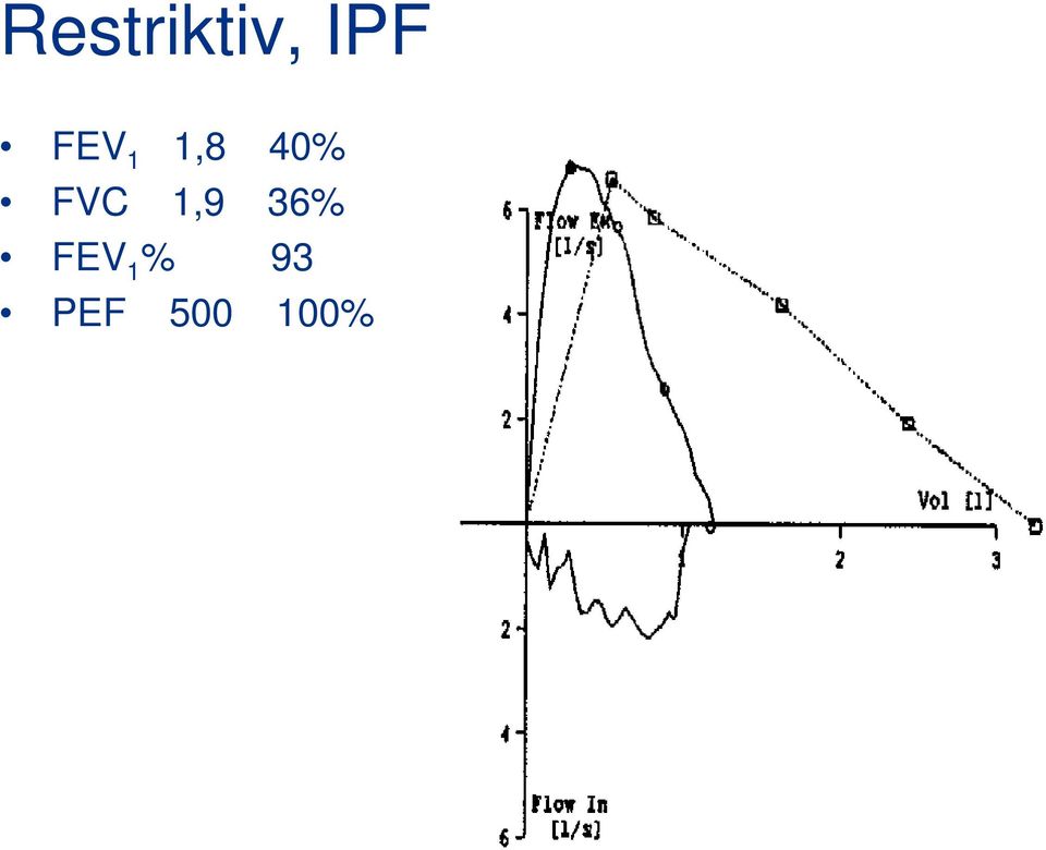 FVC 1,9 36% FEV