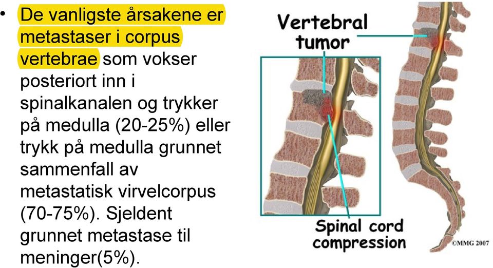 (20-25%) eller trykk på medulla grunnet sammenfall av